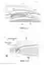 Fig. 08 - Intraocular lens system and method for power adjustment