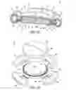 Fig. 06 - Accommodating intraocular lens having peripherally actuated deflectable surface and method