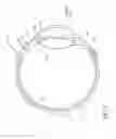 Fig. 02 - Intraocular lens