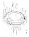 Fig. 04 - Intraocular lens