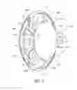 Fig. 06 - Intraocular lens