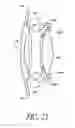 Fig. 22 - Intraocular lens