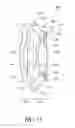 Fig. 32 - Intraocular lens
