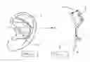 Fig. 02 - Surgical scaffold