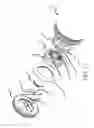 Fig. 07 - Intervertebral spinal disc prosthesis
