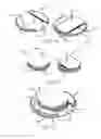 Fig. 09 - Intervertebral spinal disc prosthesis