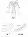 Fig. 05 - Face cradles, or head cradles