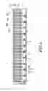 Fig. 06 - Healthy bed for actively supporting a human spine curve