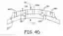 Fig. 08 - Assembly methods for medical electrical leads
