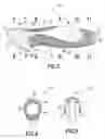 Fig. 03 - Impaired grip knife