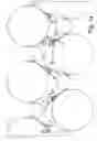 Fig. 02 - Method, a blade holder and a doctor apparatus for detaching a web threading tail from a moving surface in a fiber web machine