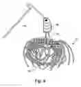 Fig. 07 - Lure skirt