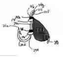 Fig. 01 - Refillable Bait Bag Having Reclosable Opening