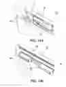 Fig. 14 - Anchorage system of ventilated facades