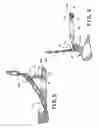 Fig. 06 - Anchor retrieval device, system and method