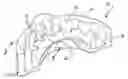 Fig. 01 - Mouth guard