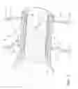 Fig. 04 - Tire treatment device with shock absorption and vehicle misalignment tolerance