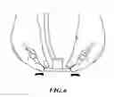 Fig. 07 - DISPOSABLE STETHOSCOPE GLOVE AND METHOD