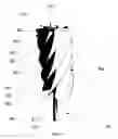 Fig. 06 - Venturi Effect Fluid Turbine