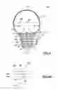 Fig. 09 - Opto-thermal solution for multi-utility solid state lighting device using conic section geometries