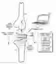 Fig. 01 - SYSTEM AND METHOD FOR INTEGRATED ANTENNA IN A SENSING MODULE FOR MEASUREMENT OF THE MUSCULAR-SKELETAL SYSTEM