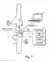 Fig. 02 - SYSTEM AND METHOD FOR INTEGRATED ANTENNA IN A SENSING MODULE FOR MEASUREMENT OF THE MUSCULAR-SKELETAL SYSTEM