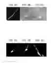 Fig. 06 - Advanced clustering method for material separation in dual energy CT