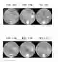 Fig. 09 - Advanced clustering method for material separation in dual energy CT