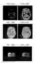 Fig. 10 - Advanced clustering method for material separation in dual energy CT