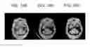 Fig. 14 - Advanced clustering method for material separation in dual energy CT