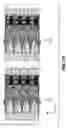Fig. 19 - Flow through dispenser including improved guide structure