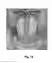 Fig. 11 - System and method for high dynamic range image sensor sensitive array