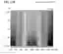 Fig. 32 - Liquid crystal display device