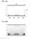 Fig. 34 - Liquid crystal display device