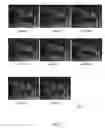 Fig. 08 - Multi-view video compression and streaming based on viewpoints of remote viewer