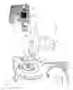 Fig. 02 - Image guided radiation therapy