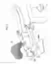 Fig. 04 - Image guided radiation therapy