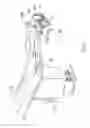 Fig. 06 - Image guided radiation therapy
