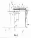 Fig. 02 - Dental X-ray device and X-ray sensor