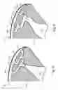 Fig. 07 - Electroacoustic transducing with a bridge phase plug