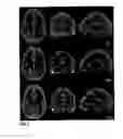 Fig. 02 - Imaging of moving objects
