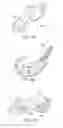 Fig. 22 - Patient Selectable Knee Joint Arthroplasty Devices