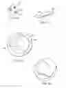 Fig. 35 - Patient Selectable Knee Joint Arthroplasty Devices