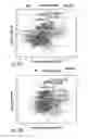 Fig. 09 - Methods, Systems and Computer Program Products for Analyzing Histology Slide Images