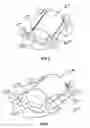 Fig. 06 - Rolling bearing cage