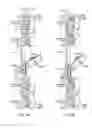 Fig. 04 - Drilling rig ice protector apparatus and methods