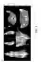 Fig. 03 - METHOD OF FIXING AND EXPRESSING PHYSIOLOGICALLY ACTIVE SUBSTANCE