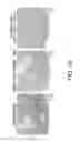 Fig. 11 - METHOD OF FIXING AND EXPRESSING PHYSIOLOGICALLY ACTIVE SUBSTANCE