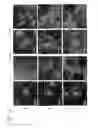 Fig. 04 - MESP1 AS A MASTER REGULATOR OF MULTIPOTENT CARDIOVASCULAR PROGENITOR SPECIFICATION AND USES THEREOF