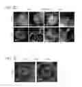 Fig. 07 - MESP1 AS A MASTER REGULATOR OF MULTIPOTENT CARDIOVASCULAR PROGENITOR SPECIFICATION AND USES THEREOF